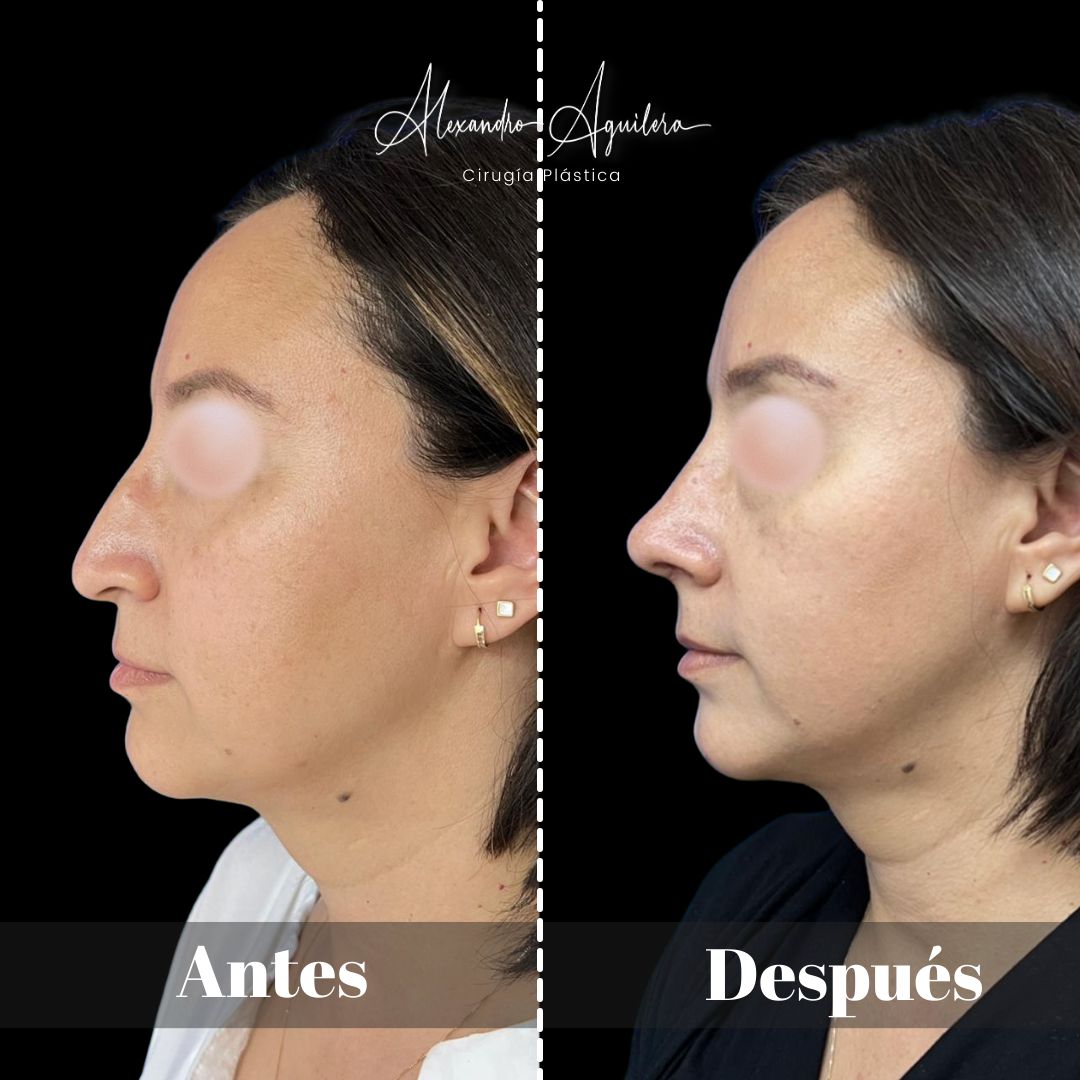 Alexandro Aguilera Salgado-47