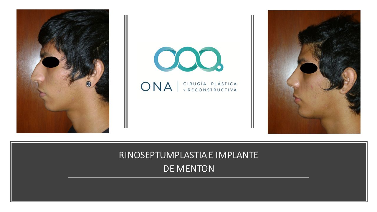 José Luis Segura Castillo-15