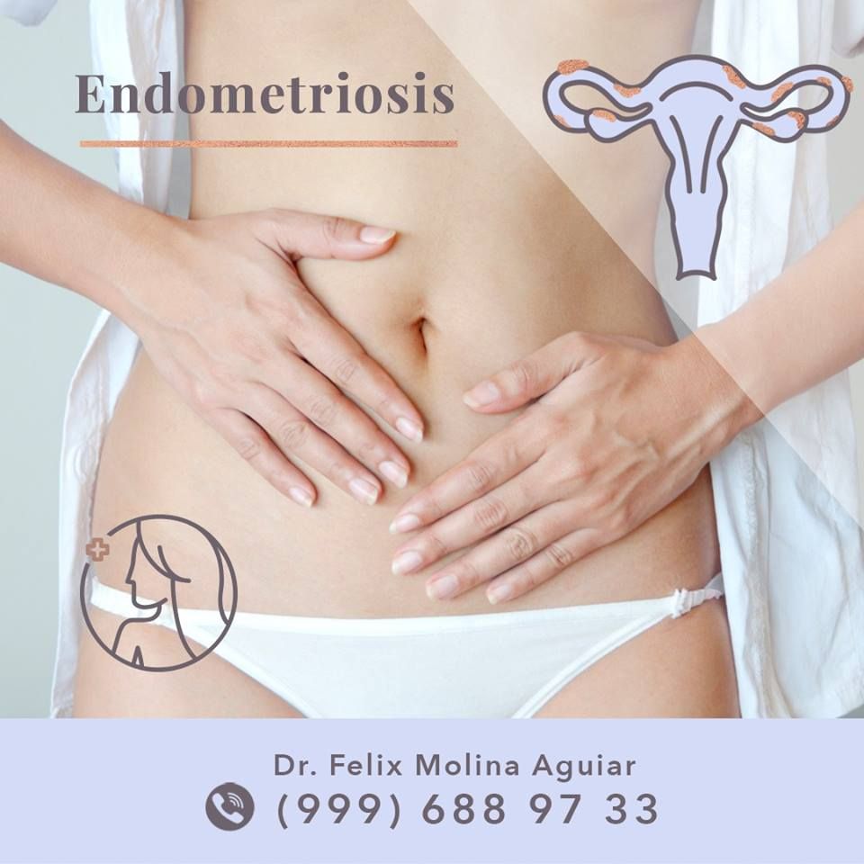 Félix José Molina Aguiar-15