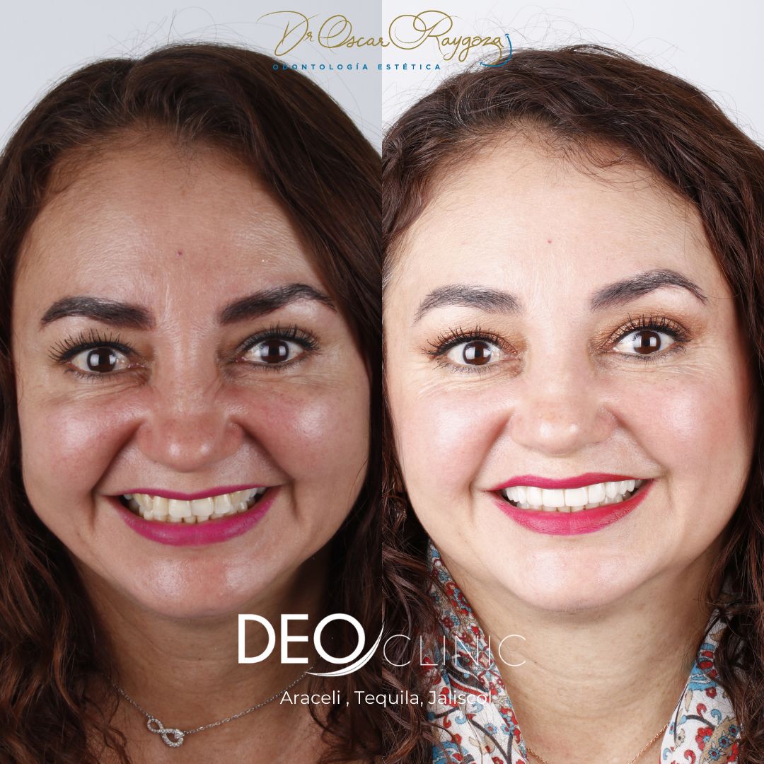 Oscar Raygoza Carrillo-33