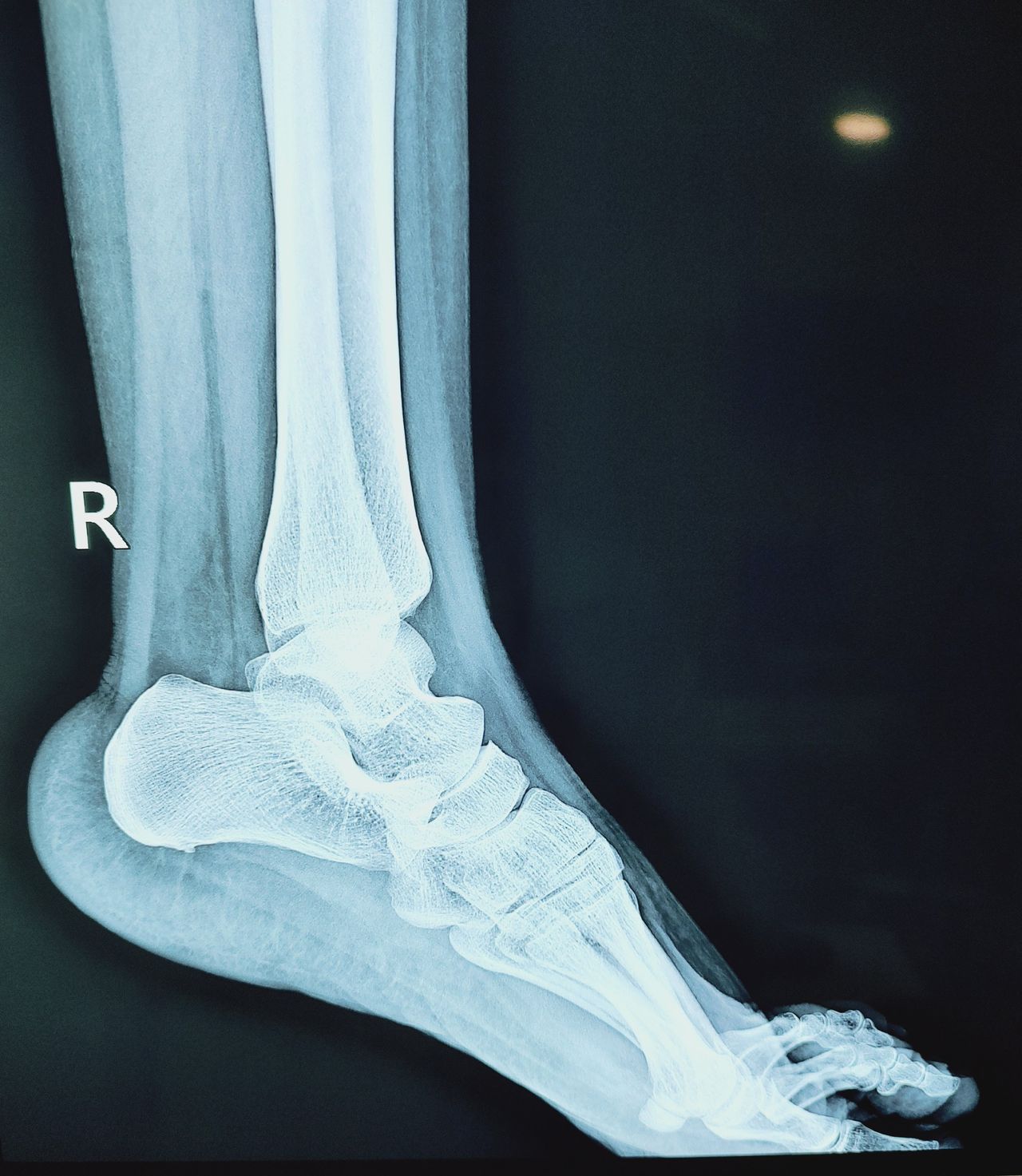 Lizeth Patricia Mena Rivas-12