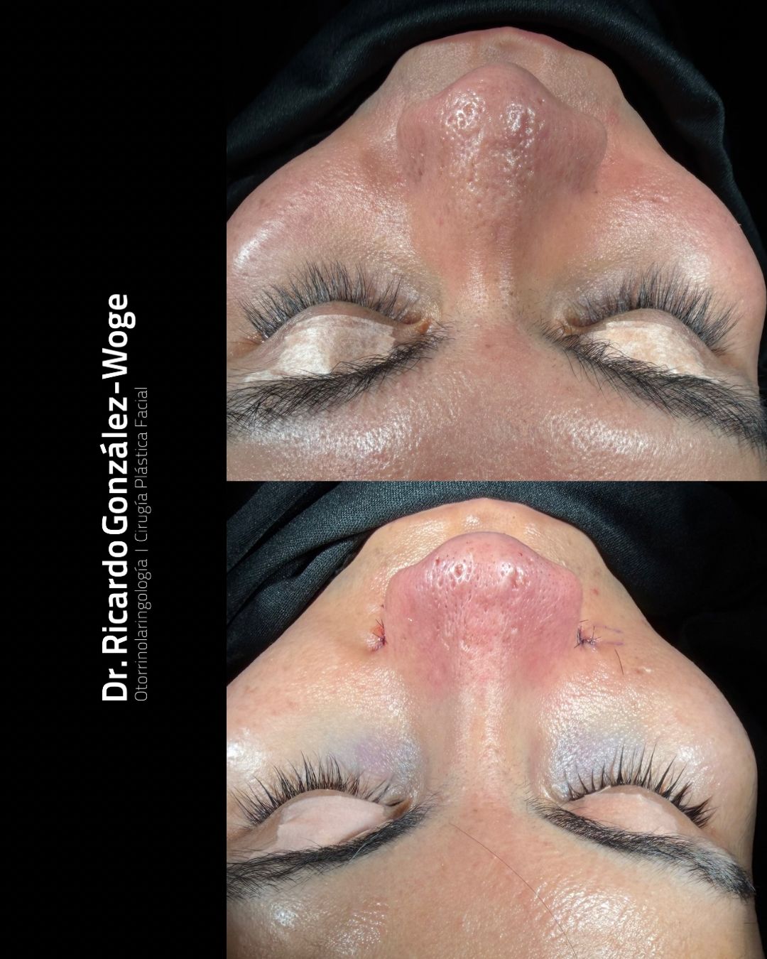 Ricardo Gonzalez Woge-25