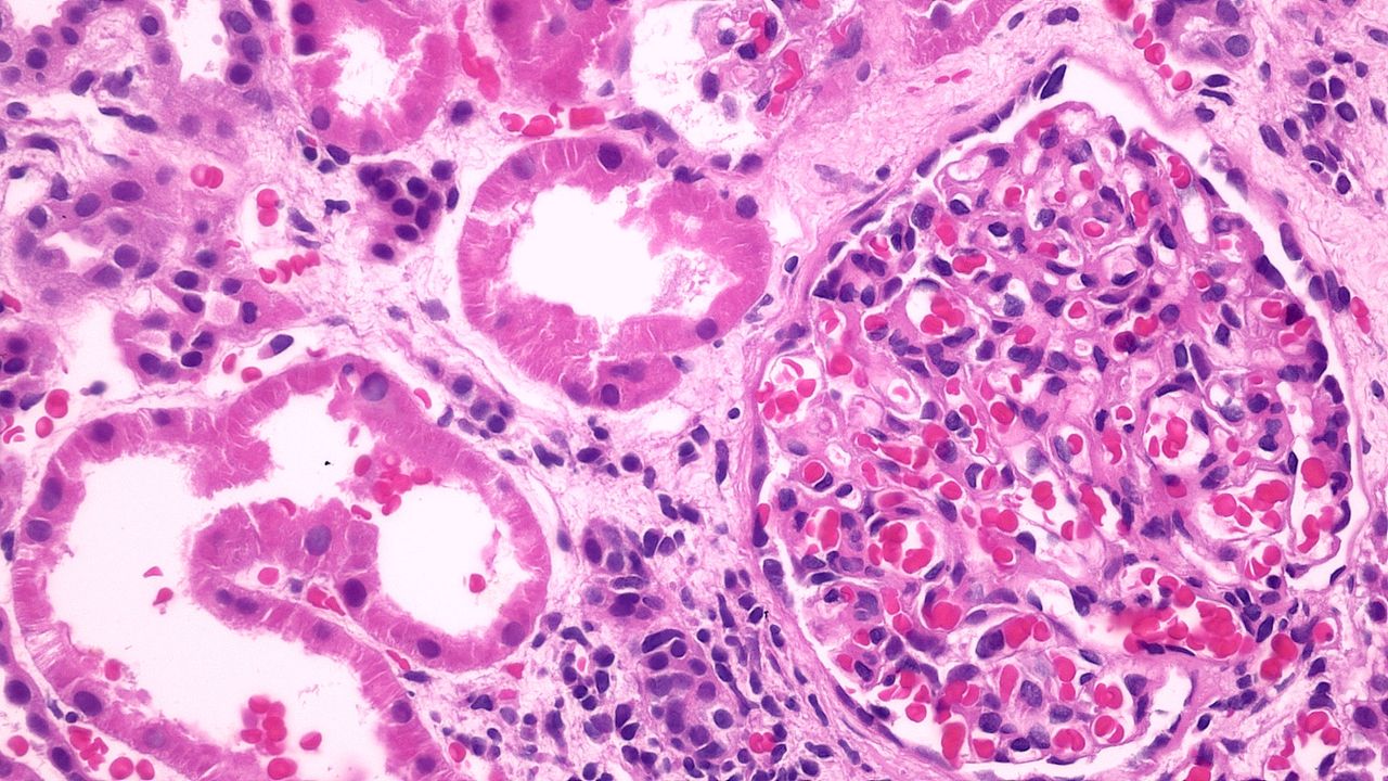 Cindy Paola Salazar Gana-23