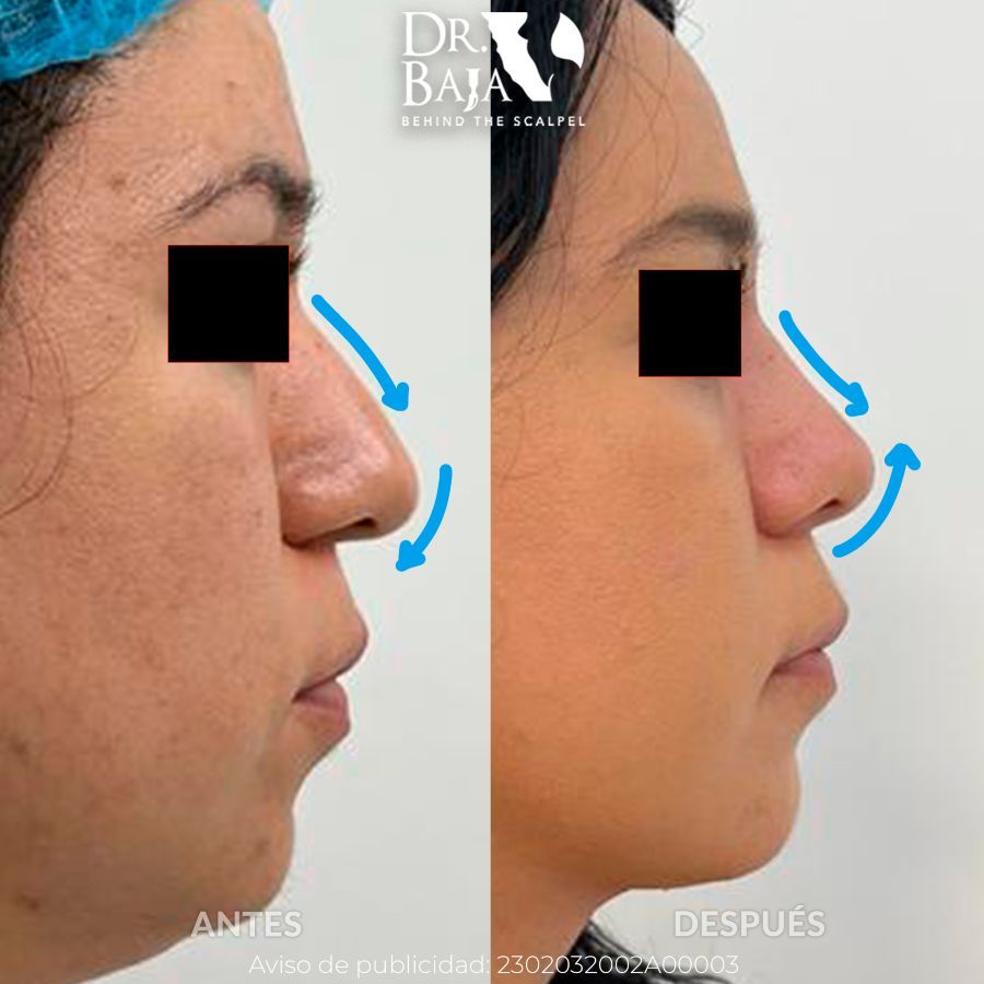 Renato Rodríguez Hirales-25