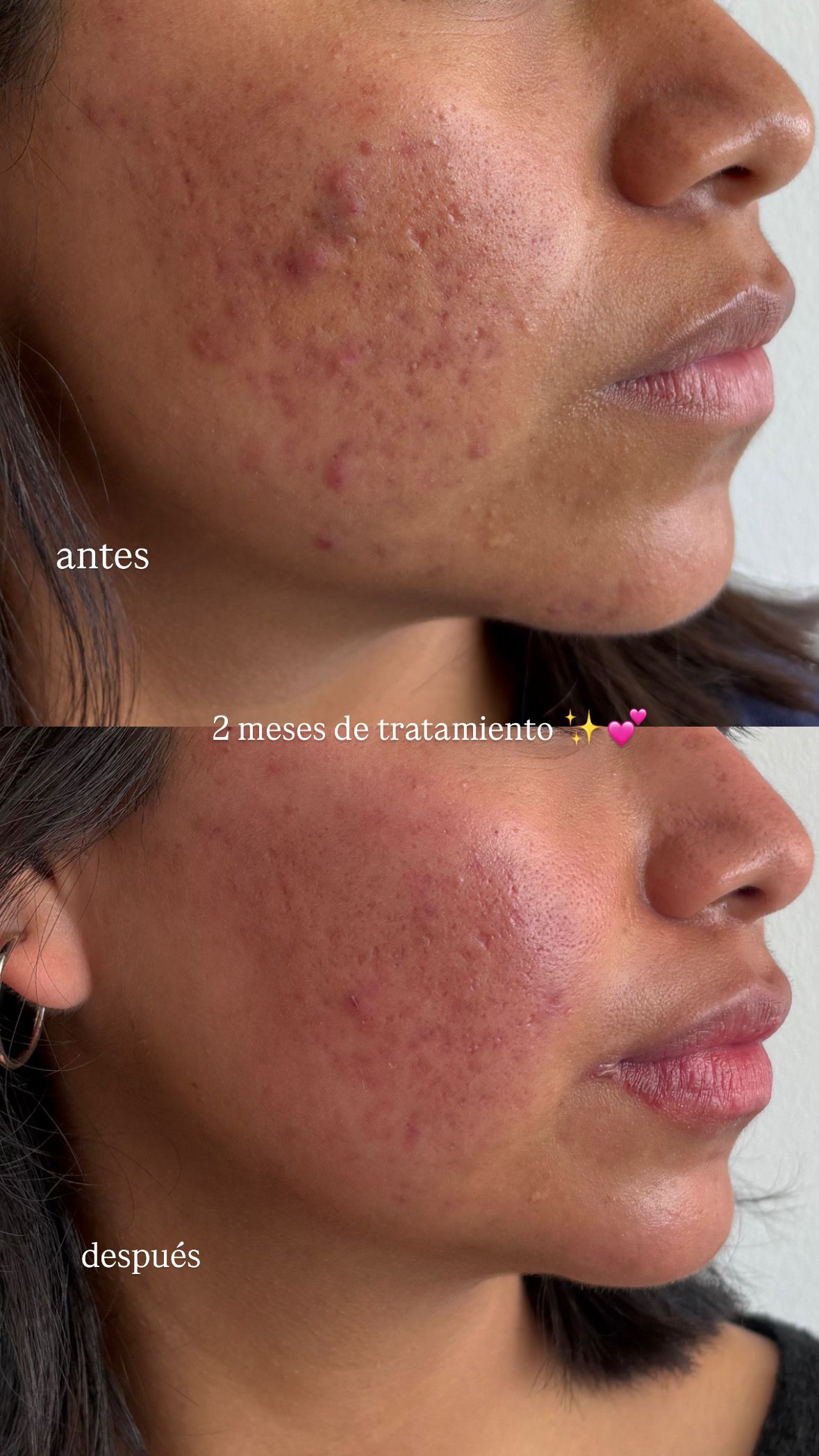 Venecia Landini Enríquez-12