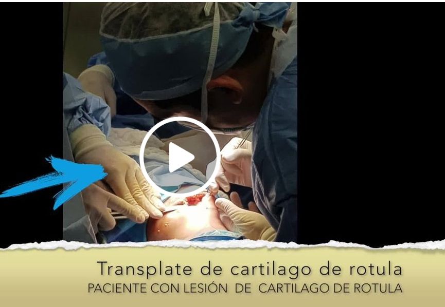 Juan Carlos Flores Raya-31