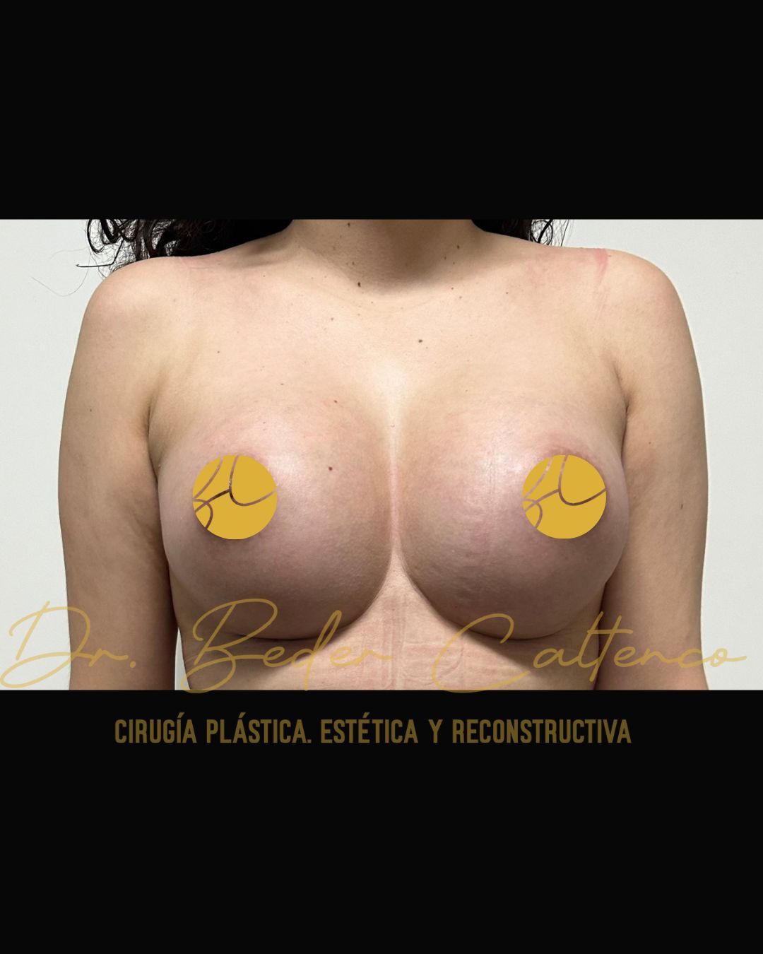 Beder Raúl Caltenco Solis-0