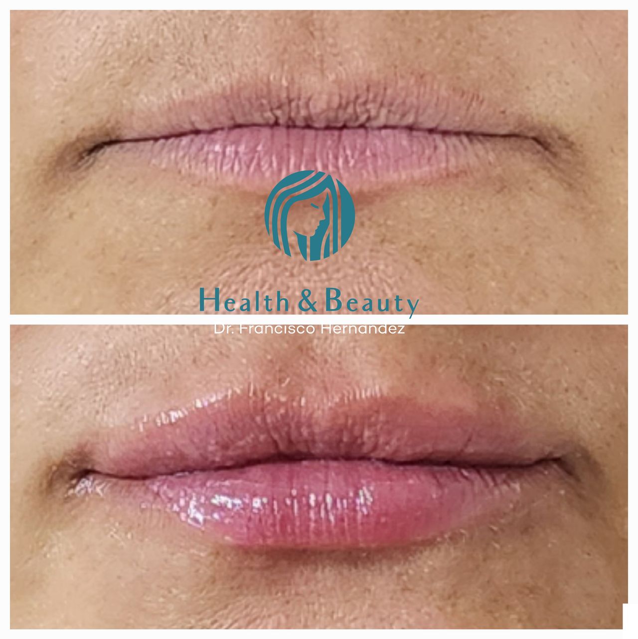 Francisco Hernández Gómez Crespo-73