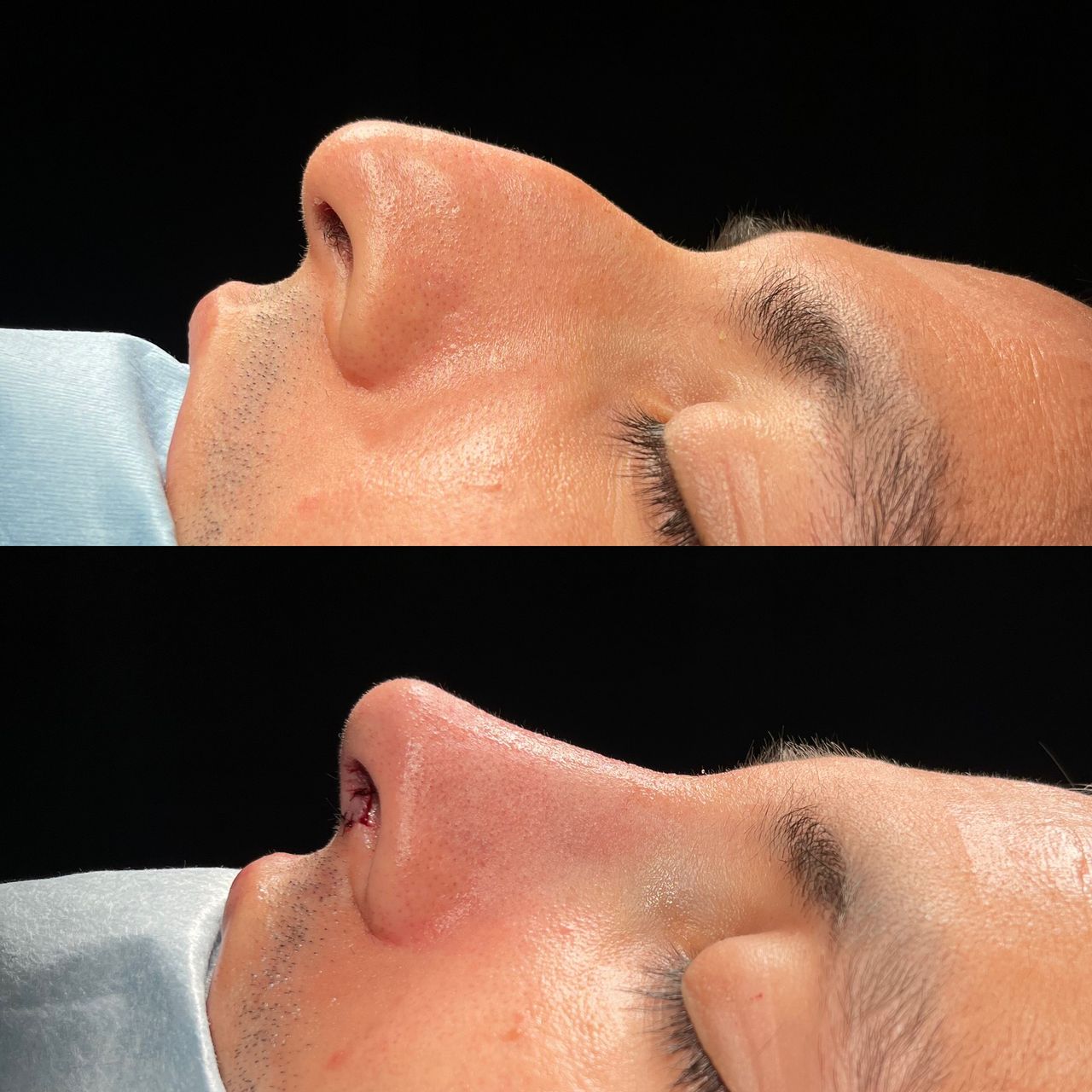 Angel Castro Urquizo-160