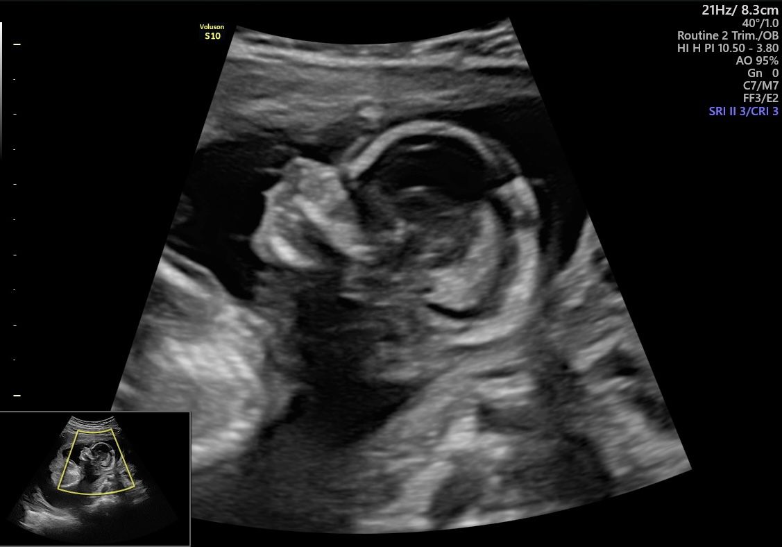 Juan Jose Pacheco Uc-10