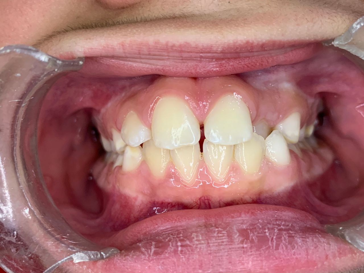 Patricia Rizo Palos-24