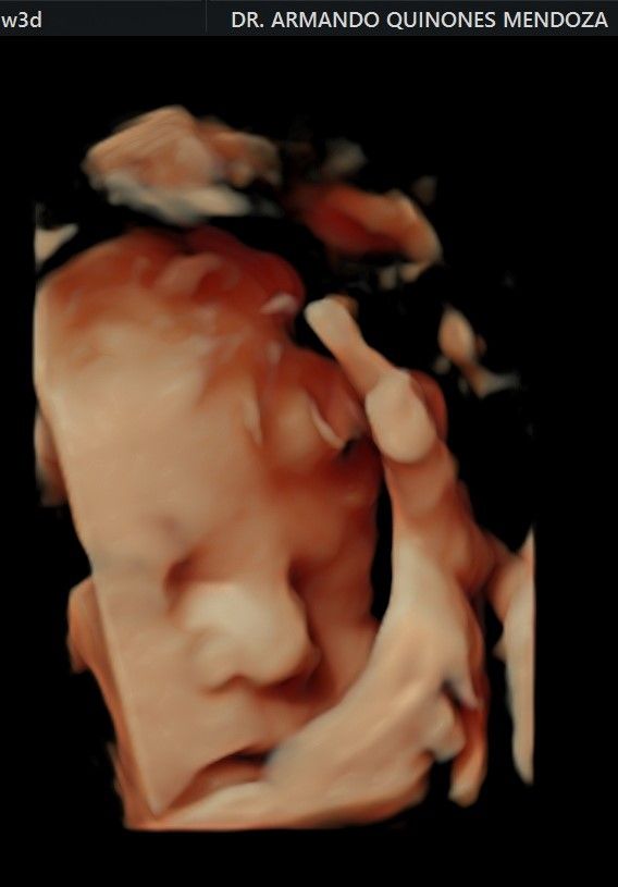 Armando Quiñones Mendoza-12