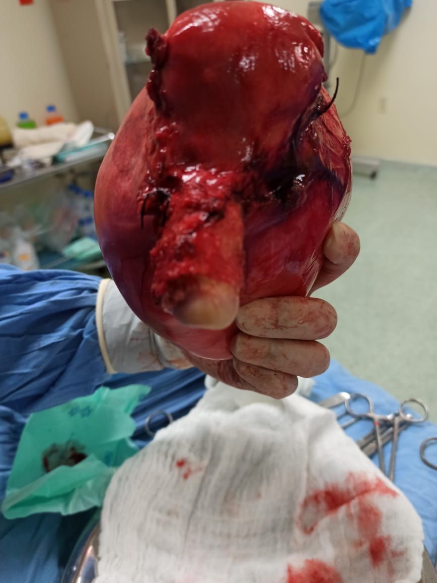 Marisol I. Alvarez Carrasco-16