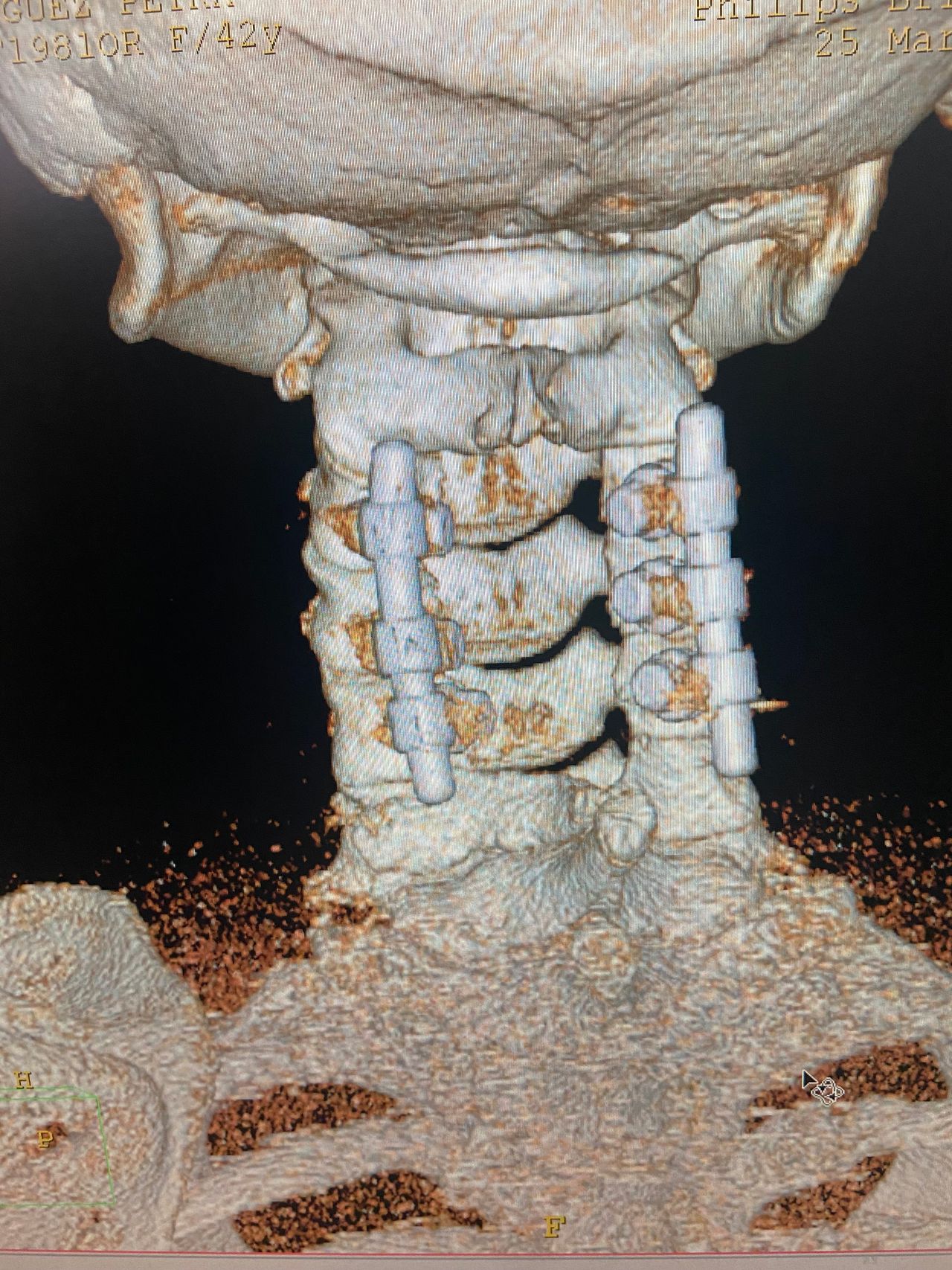 Marco Antonio Díaz Montoya-8