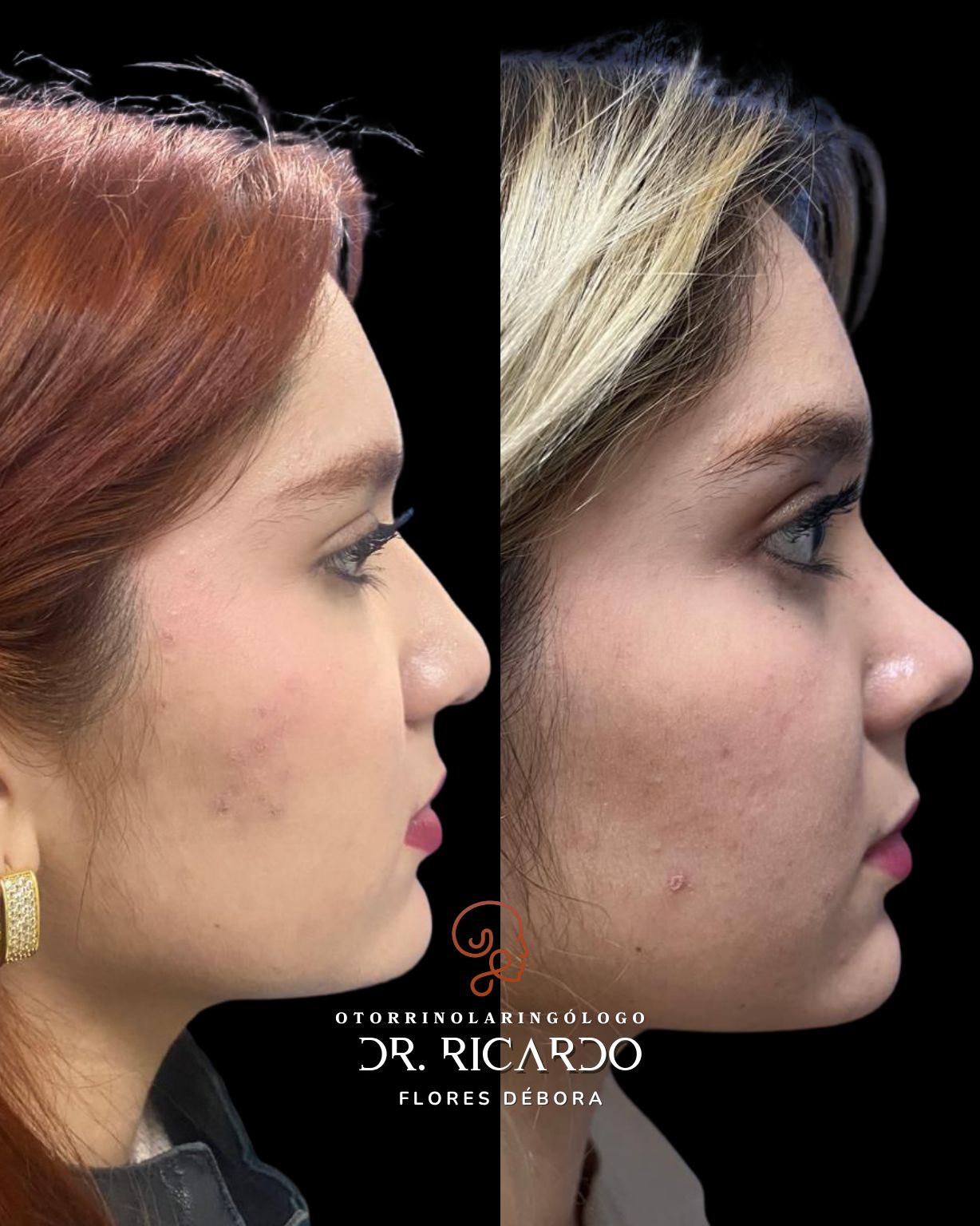 Ricardo Flores Débora-5