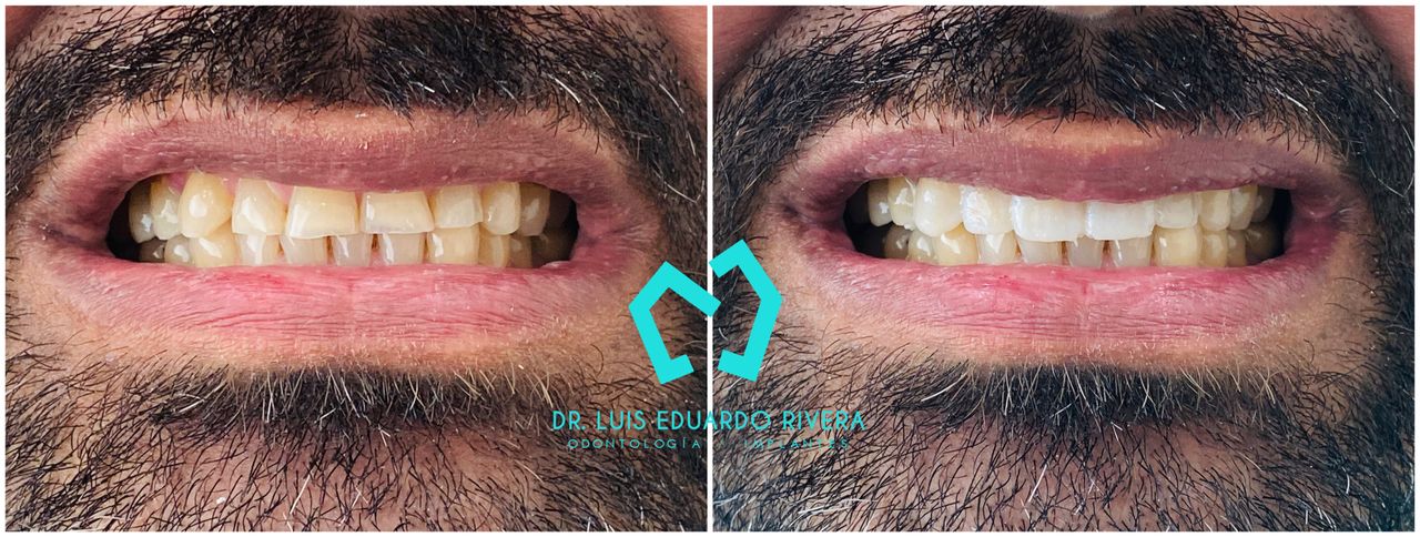 Luis Eduardo Rivera-97