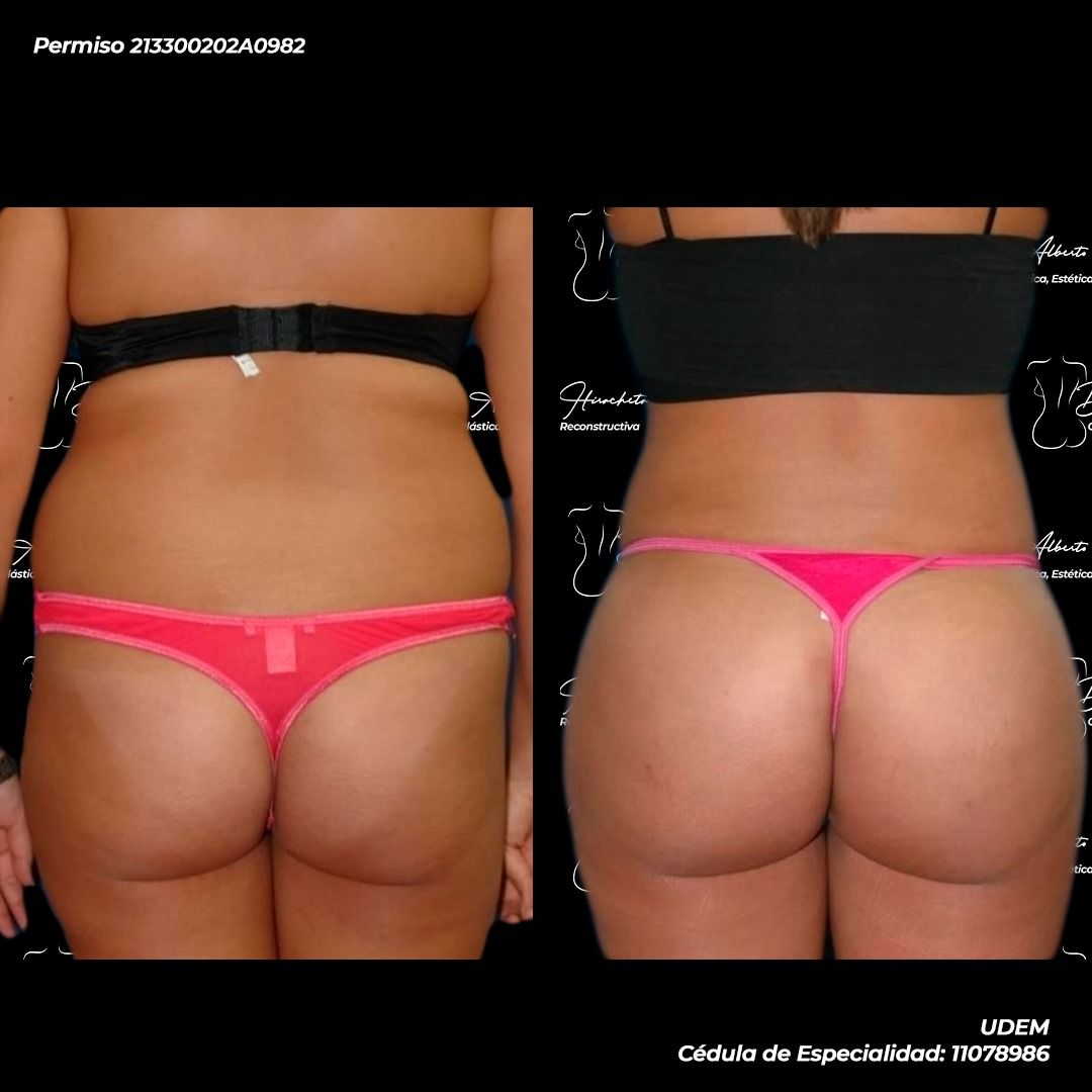 Alberto Hiracheta Torres-16