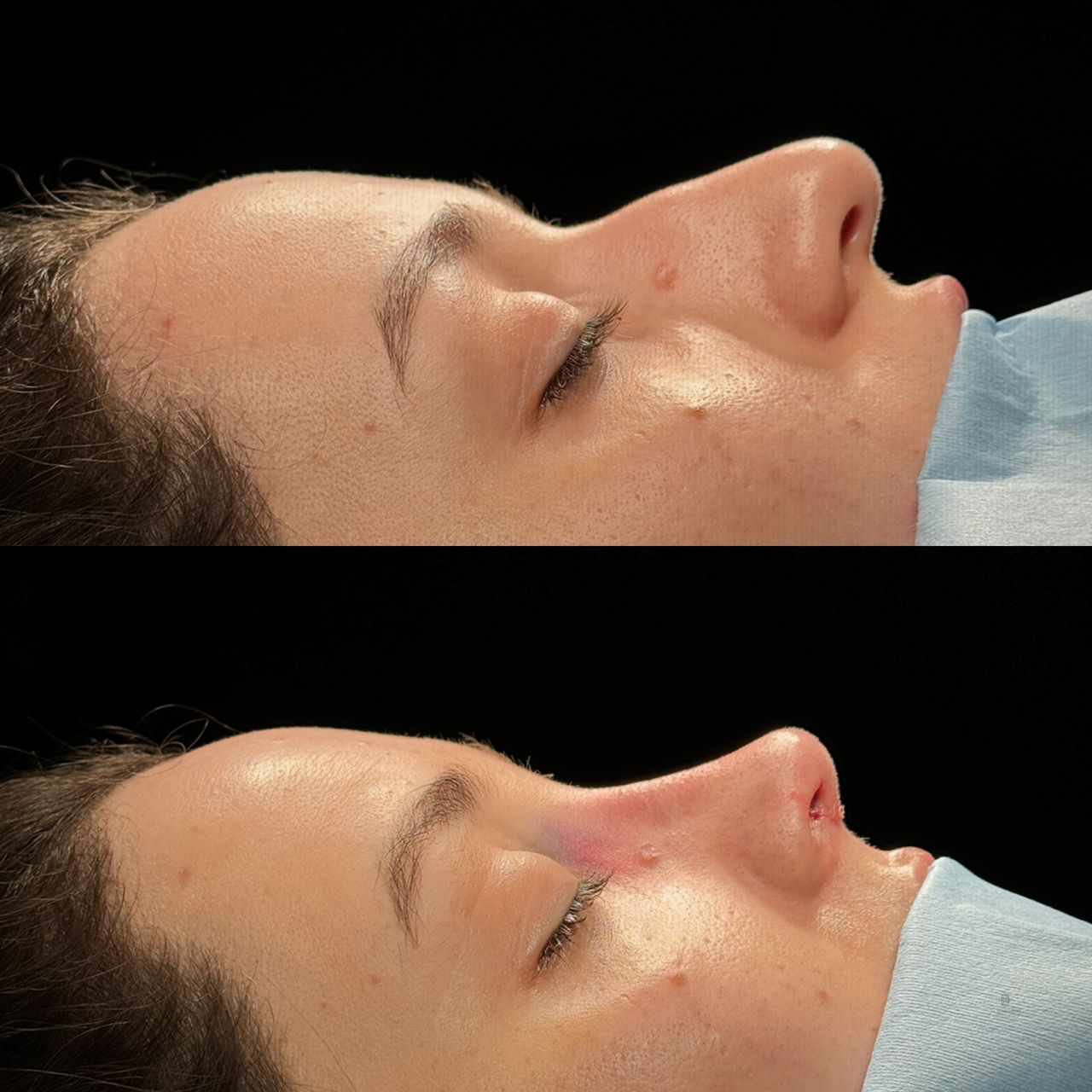 Angel Castro Urquizo-44