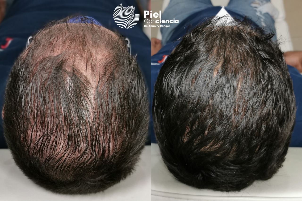 Víctor Amaury Rangel Avilés-29