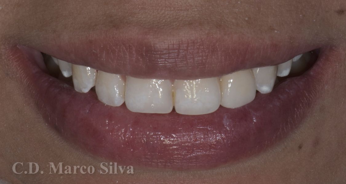 Marco Antonio Silva-7