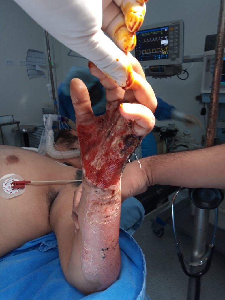 Federico Quintana De La Rosa-47