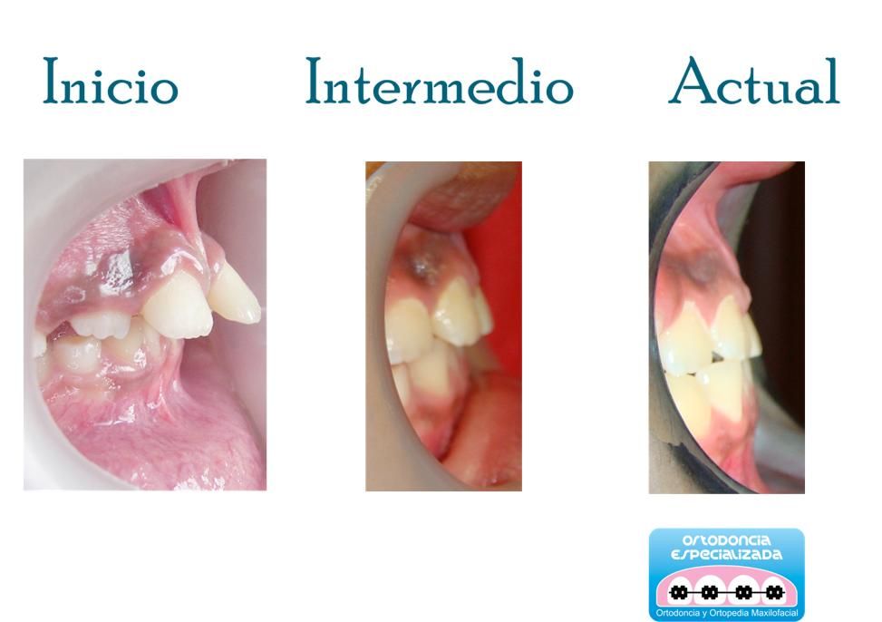 Mireya Quiroga Zamora-2
