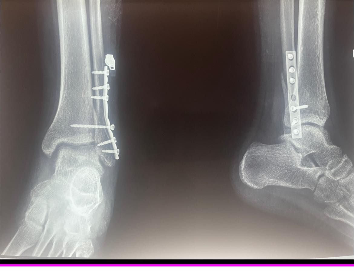 Felix Alfaro Arias-45