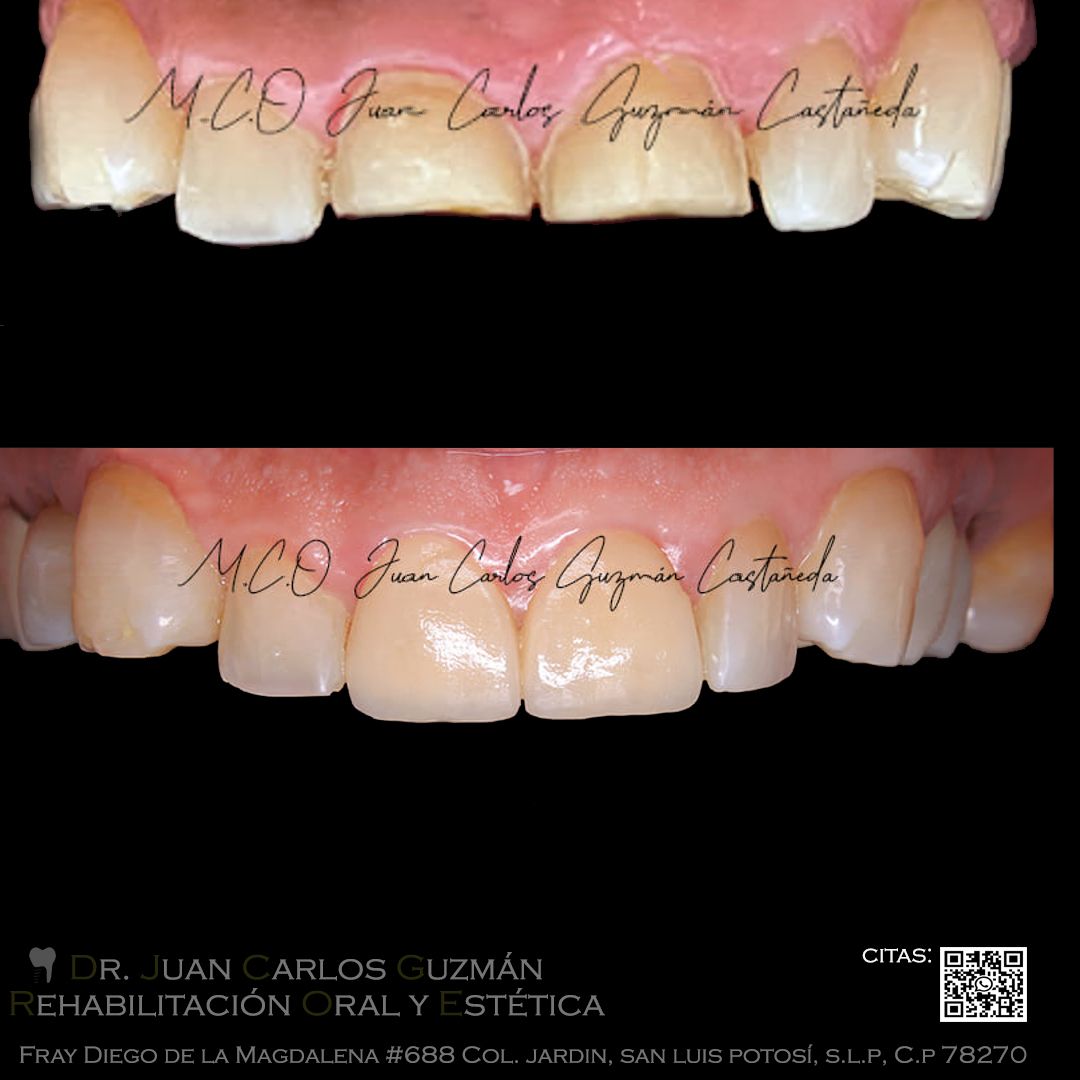 Juan Carlos Guzmán Castañeda-20