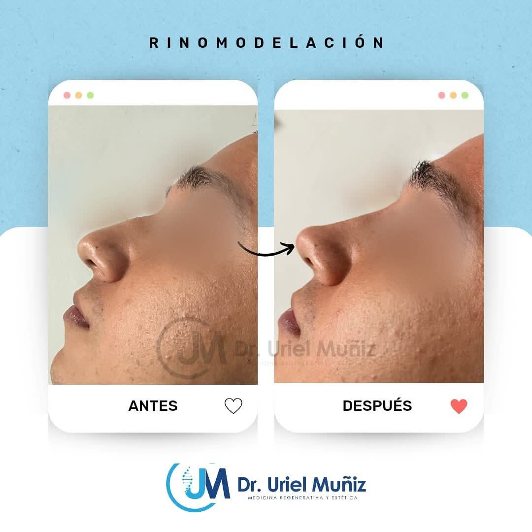 Teófilo Uriel Muñiz Chávez-57