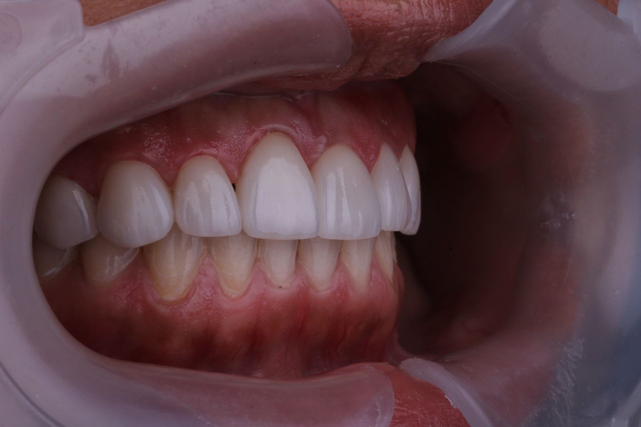 Josué Márquez Gómez-51