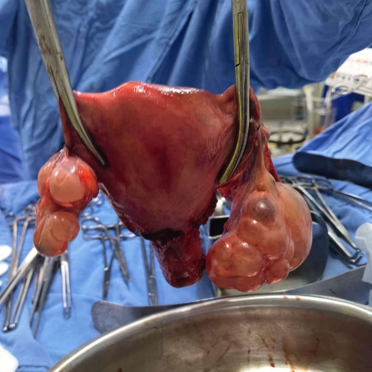 Andrea Calvo Maldonado-1