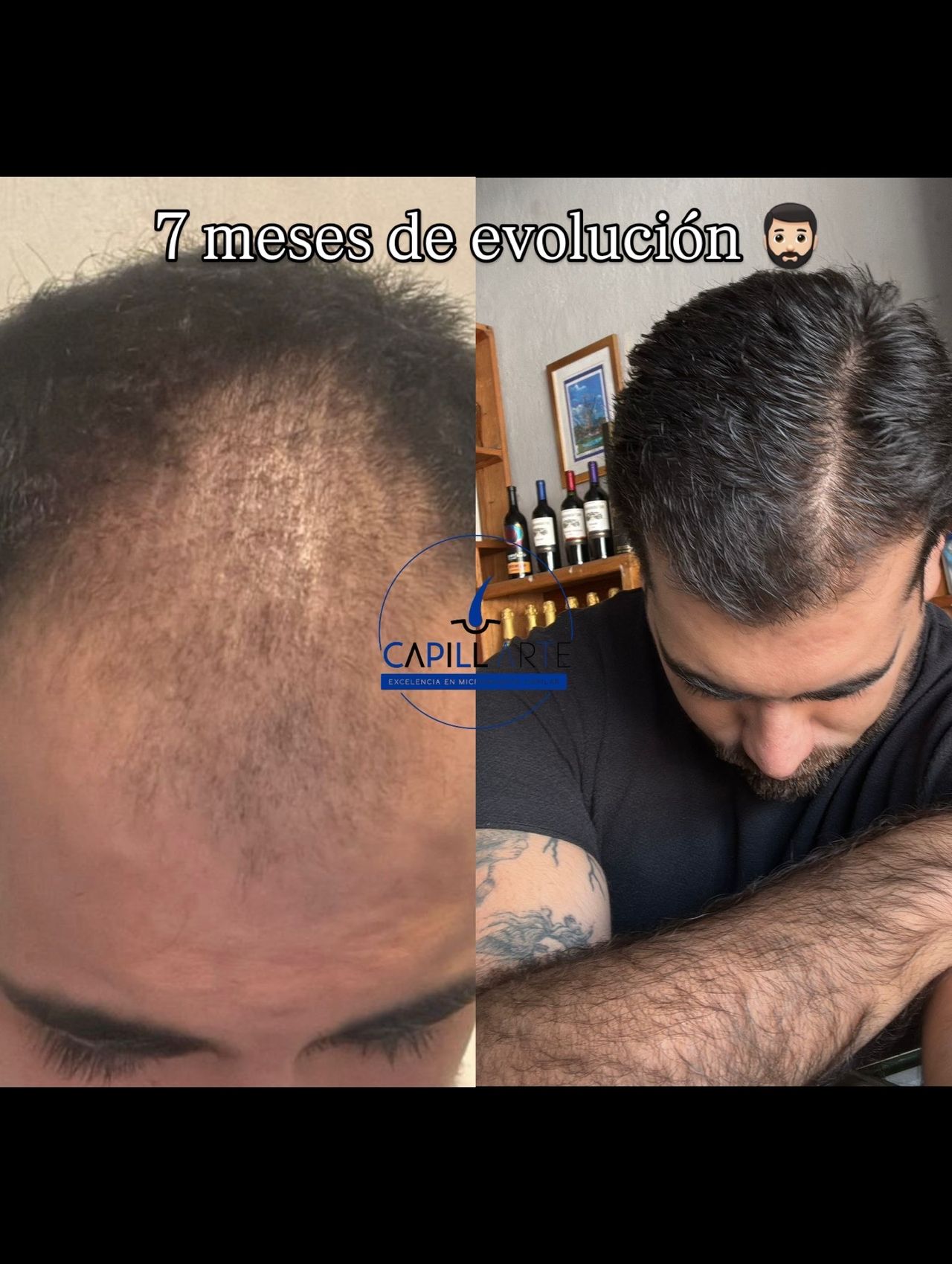 Adrian Hernandez Lopez-5