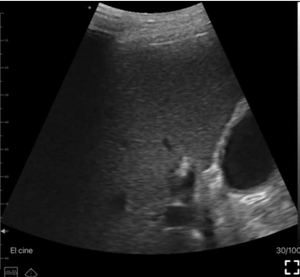 Juanita Pérez Escobar-7