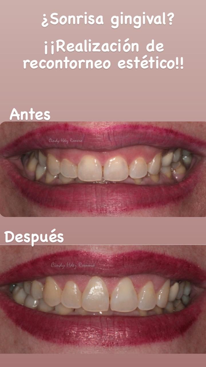 Cindy Hernandez Romero-4