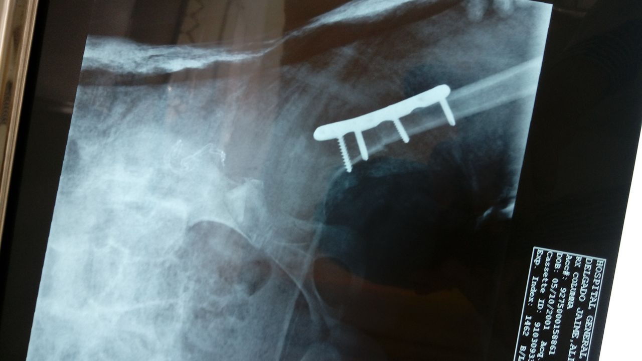 Valerio Licerio De La Cruz-3