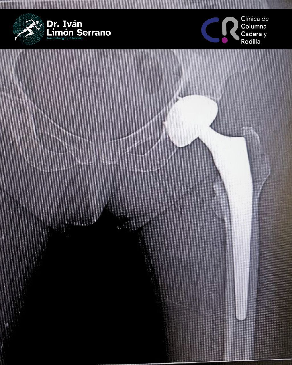 Iván Limón Serrano-37