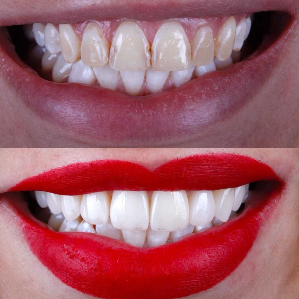 Oscar Raygoza Carrillo-11