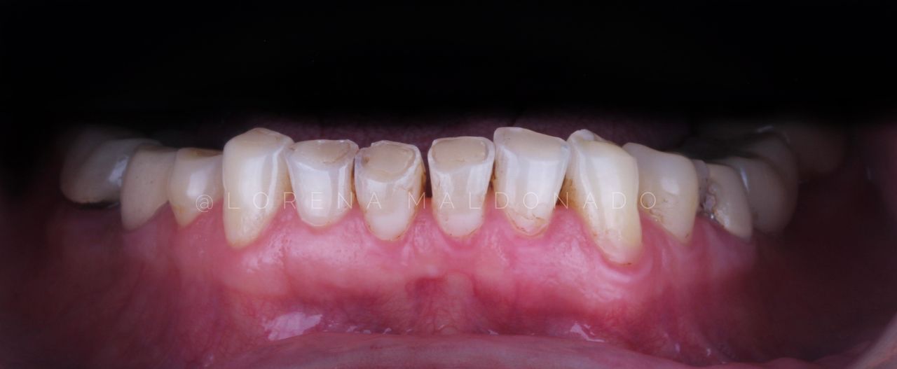 Ana Lorena Maldonado Munguia-11