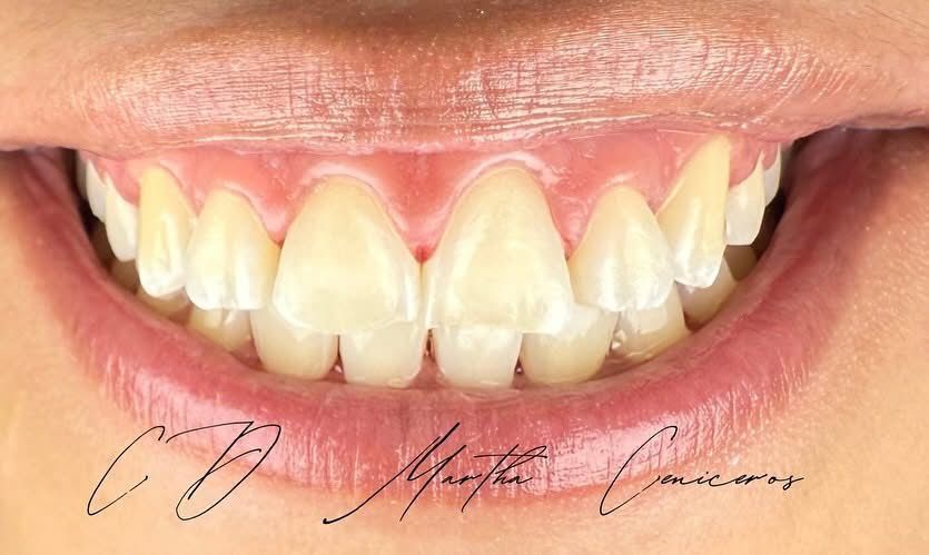 Martha Alicia Ceniceros Betancourt-25