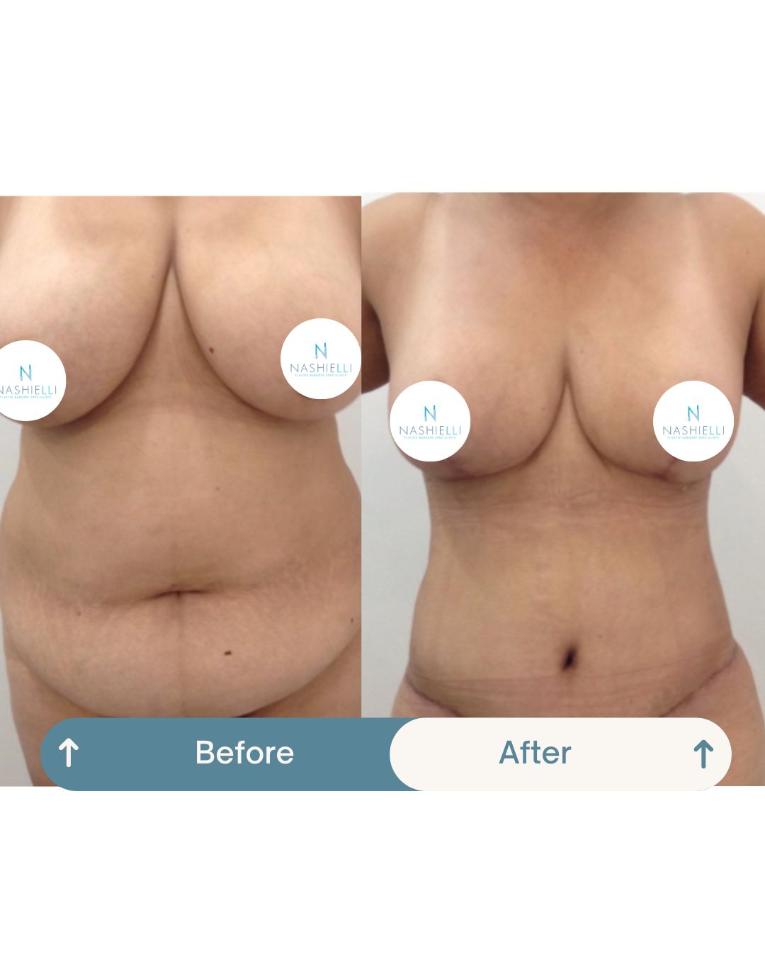 Nashielli Torres Espinosa Chiu-24