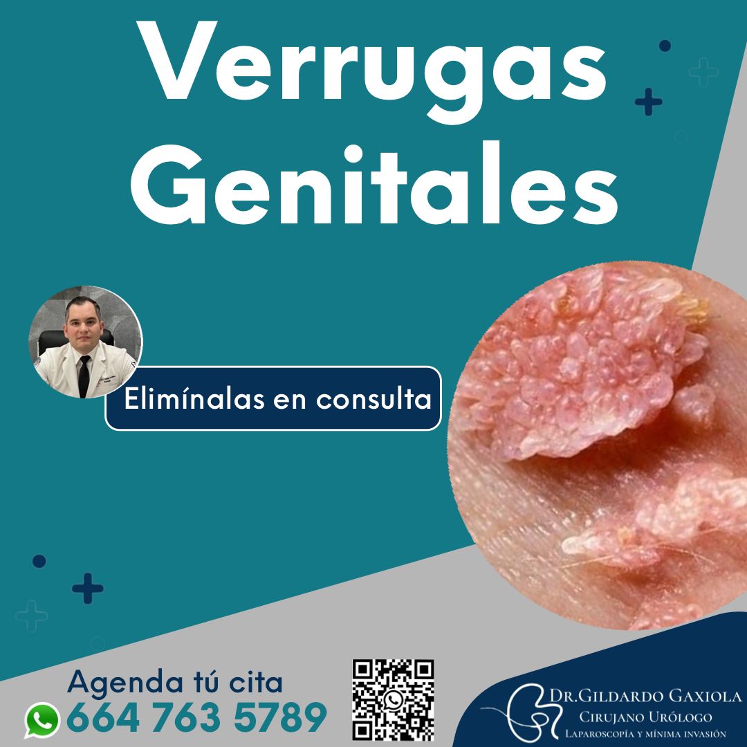 José Gildardo Gaxiola Cervantes-8