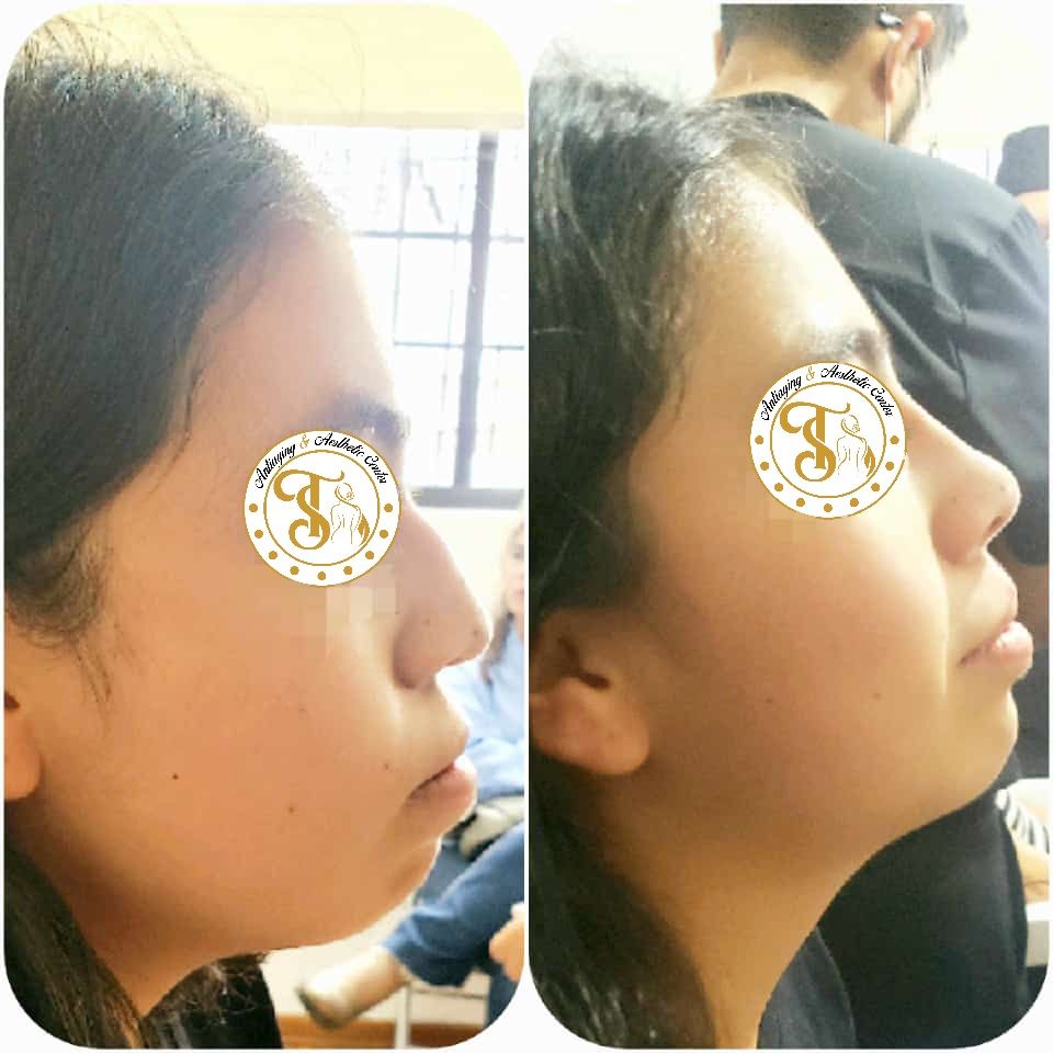 Samuel Torres Torres-5