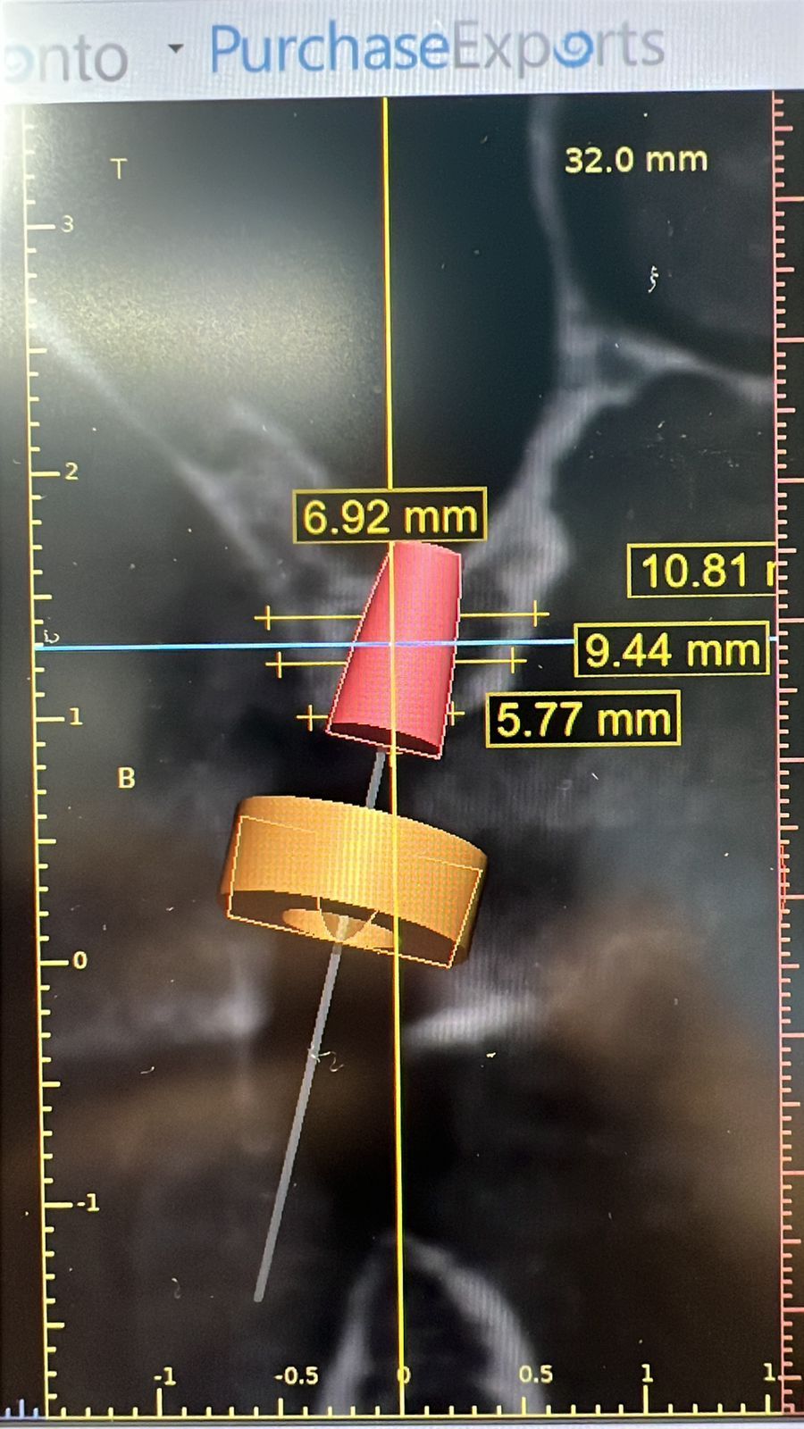 Jair Contreras García-32