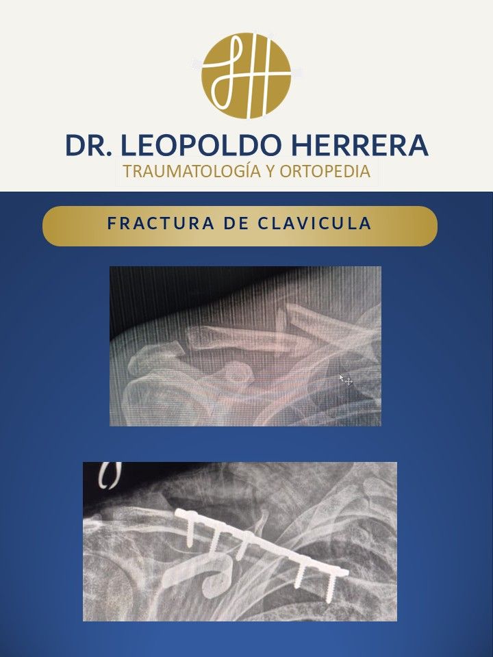 Leopoldo José Herrera Camacho-16