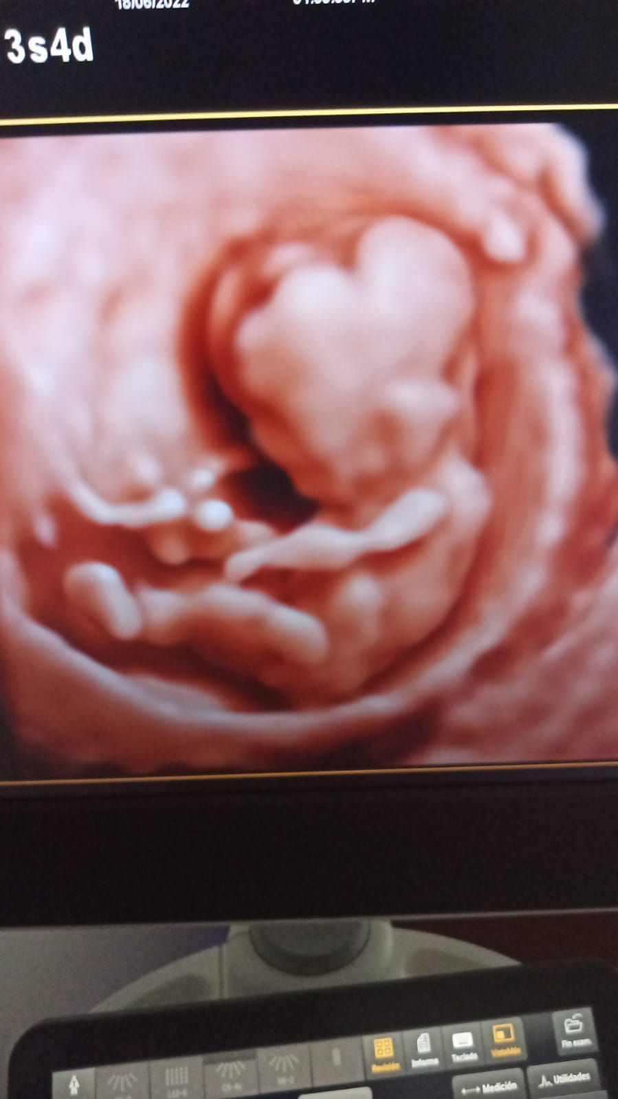 Carlos Gabriel Briones Vega-6