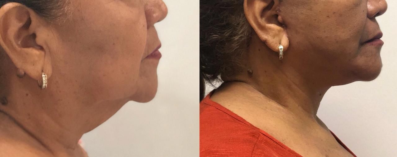 María Luisa Pantoja Silveira-3