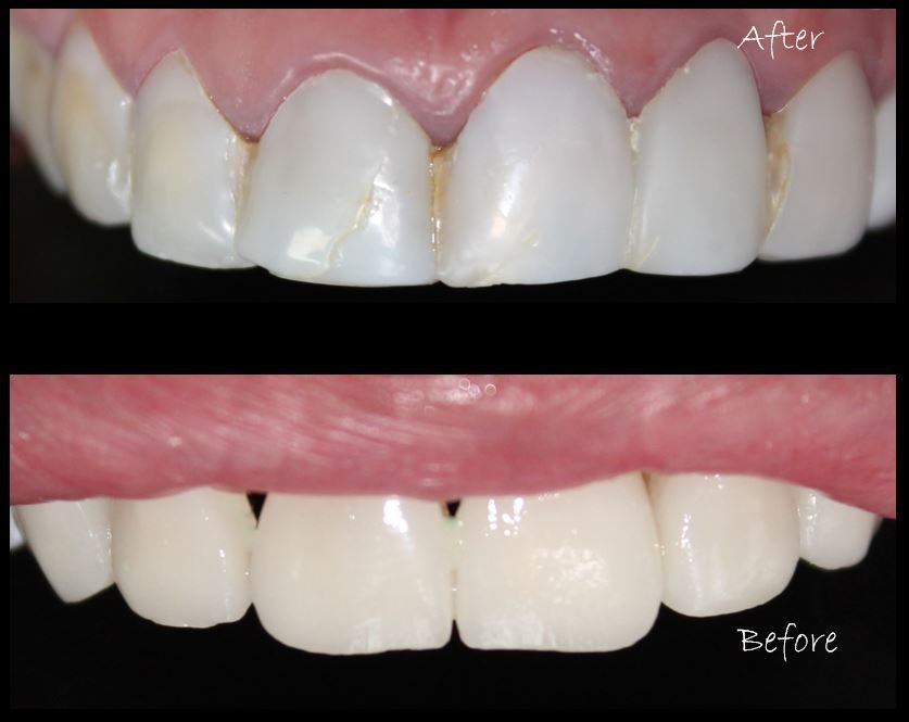 Aimee Valles Monárrez-26