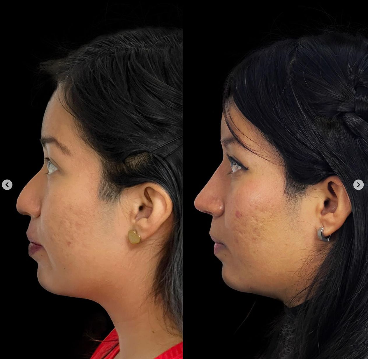 Carlos Alfonso Romero Gameros-19