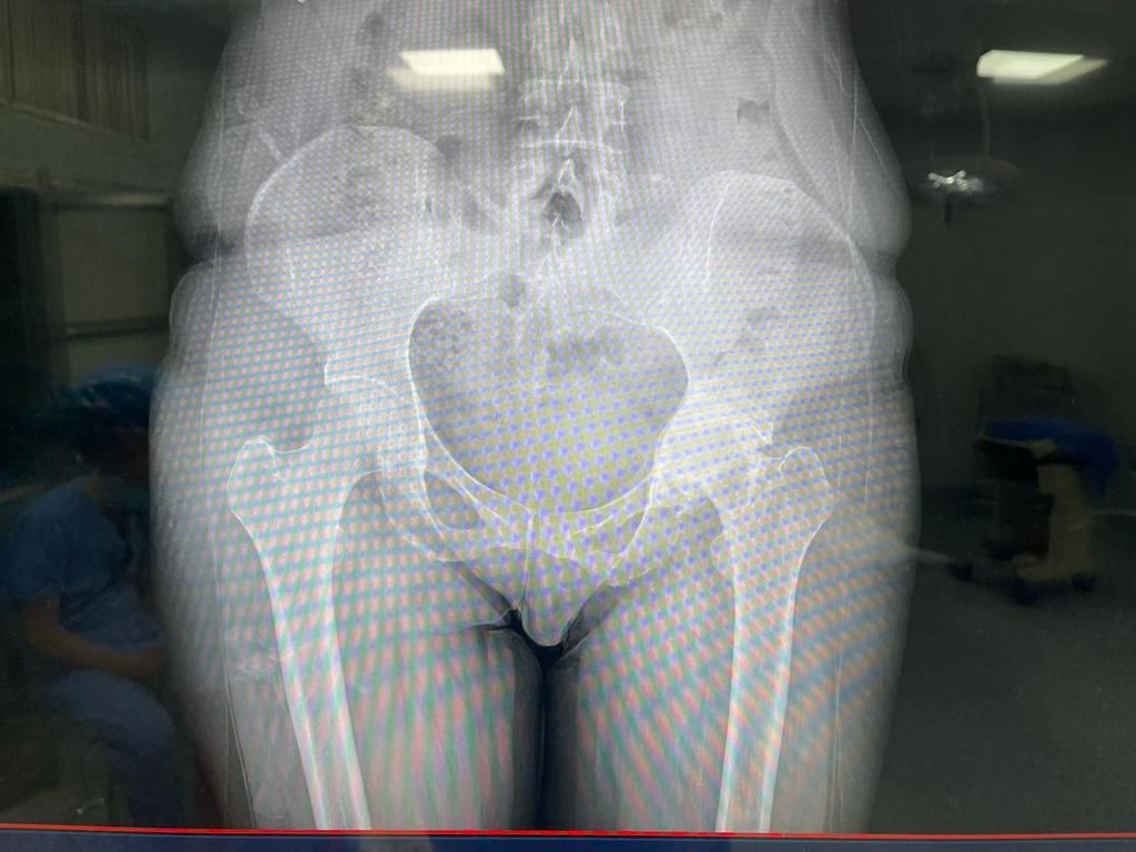 Yuri Mario Quiroz Delgadillo-1