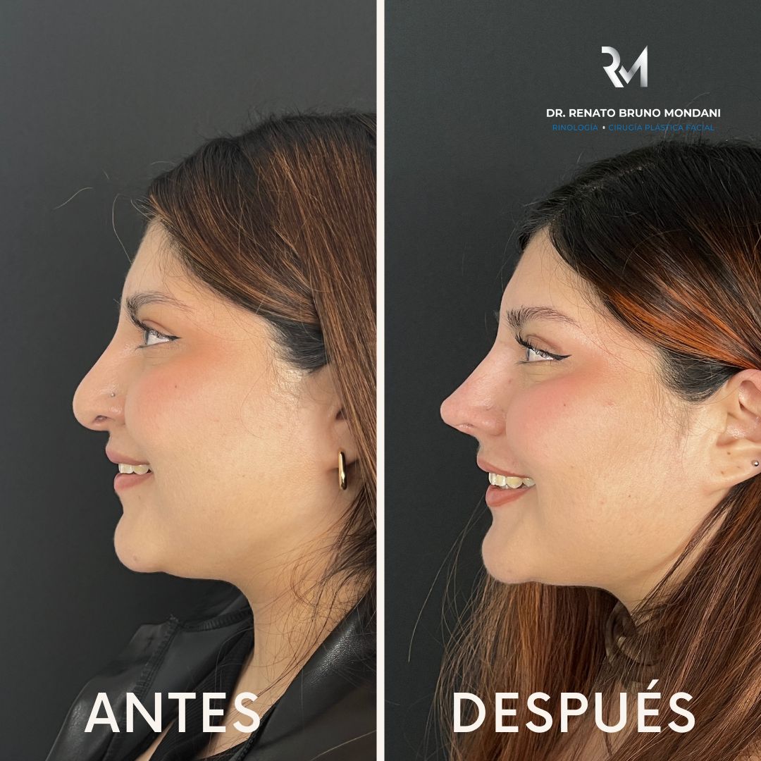 Renato Bruno Mondani-0